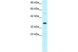 Western Blotting (WB) image for anti-General Transcription Factor IIH, Polypeptide 3, 34kD (GTF2H3) antibody (ABIN2460224)