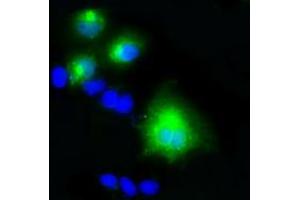 Anti-LIPG mouse monoclonal antibody (ABIN2453255) immunofluorescent staining of COS7 cells transiently transfected by pCMV6-ENTRY LIPG (RC209248). (LIPG Antikörper)