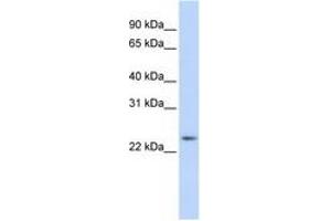 Image no. 1 for anti-RAB8A, Member RAS Oncogene Family (RAB8A) (C-Term) antibody (ABIN6741500) (RAB8A Antikörper  (C-Term))