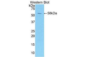 Western Blotting (WB) image for anti-Protein L-Myc (MYCL) (AA 184-454) antibody (ABIN1859919) (LMYC Antikörper  (AA 184-454))