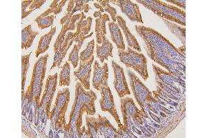 IHC analysis of PYROXD1 using anti-PYROXD1 antibody (ABIN6719650). (PYROXD1 Antikörper  (AA 48-230))