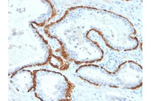 Immunohistochemistry (IHC) image for anti-Keratin 15 (KRT15) antibody (ABIN6939914)