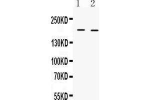 Western blot analysis of Collagen I expression in mouse kidney extract ( Lane 1) and mouse cardiac muscle extract ( Lane 2). (COL1A1 Antikörper  (C-Term))