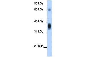 WB Suggested Anti-NOV Antibody Titration:  1. (NOV Antikörper  (Middle Region))