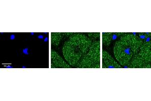 Rabbit Anti-PDK3 Antibody    Formalin Fixed Paraffin Embedded Tissue: Human Adult heart  Observed Staining: Cytoplasmic Primary Antibody Concentration: 1:100 Secondary Antibody: Donkey anti-Rabbit-Cy2/3 Secondary Antibody Concentration: 1:200 Magnification: 20X Exposure Time: 0.