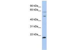 Image no. 1 for anti-Proteasome (Prosome, Macropain) 26S Subunit, ATPase, 2 (PSMC2) (N-Term) antibody (ABIN6742450) (PSMC2 Antikörper  (N-Term))