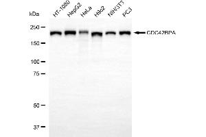 Western blotting analysis using CDC42BPA antibody (ABIN7797991). (CDC42BPA Antikörper)