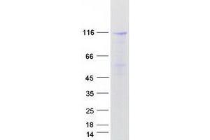 Validation with Western Blot