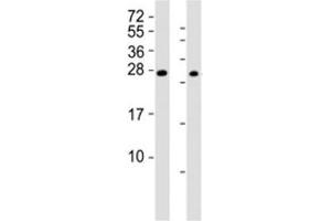 Western blot testing of RHOXF1 antibody at 1:2000; Lane 1: A2058 cell lysate, Lane 2: human ovary lysate.