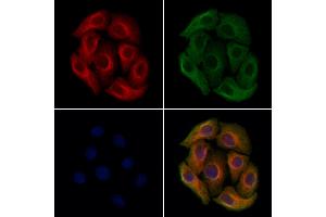 ABIN7094644 and ABIN7098694 staining Hela cells by IF/ICC. (Plastin 3 Antikörper  (Internal Region))