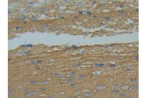 IHC-P analysis of Rat Brain Tissue, with DAB staining. (GAP43 Antikörper  (AA 8-226))