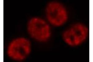 ABIN6269171 staining Hela by IF/ICC. (JunD Antikörper)