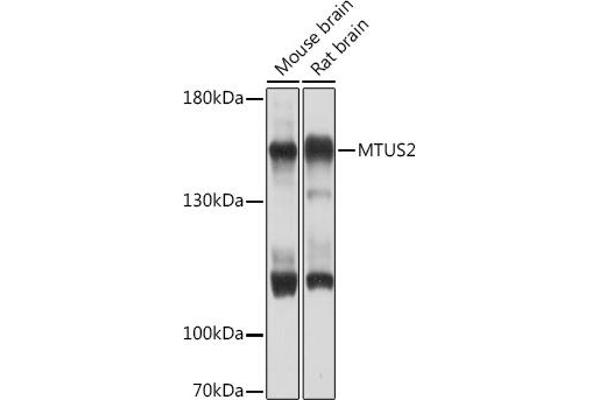 CAZIP Antikörper  (AA 49-348)