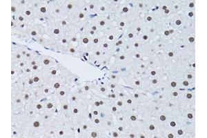 Immunohistochemistry of paraffin-embedded rat liver using PCNA antibody (ABIN1874056) at dilution of 1:100 (40x lens). (PCNA Antikörper)