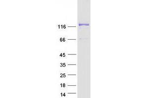 EFCAB6 Protein (Transcript Variant 2) (Myc-DYKDDDDK Tag)