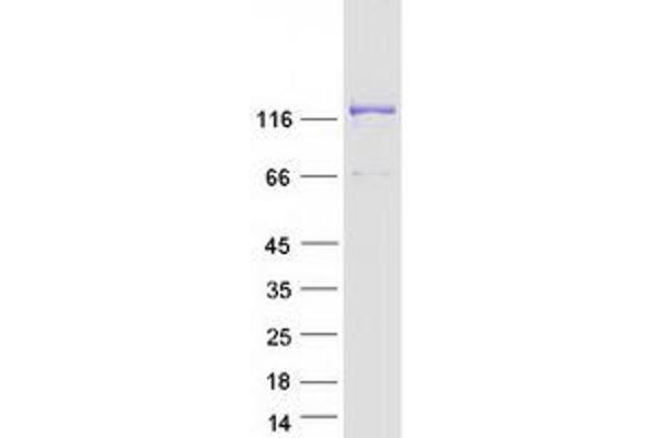 EFCAB6 Protein (Transcript Variant 2) (Myc-DYKDDDDK Tag)