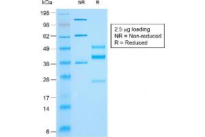 SDS-PAGE Analysis of Purified Cytokeratin 10 Mouse Recombinant Monoclonal Antibody (rKRT10/844). (Rekombinanter Keratin 10 Antikörper)