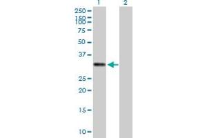 Western Blot analysis of HLA-DRA expression in transfected 293T cell line by HLA-DRA MaxPab polyclonal antibody.