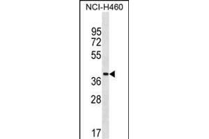 ZN Antibody (Center) (ABIN1537874 and ABIN2849918) western blot analysis in NCI- cell line lysates (35 μg/lane). (ZNF488 Antikörper  (AA 149-175))
