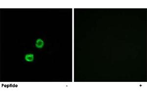 Immunofluorescence analysis of MCF-7 cells, using GCNT7 polyclonal antibody . (GCNT7 Antikörper)