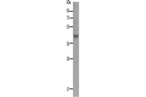 Western Blotting (WB) image for anti-Melanocortin 5 Receptor (MC5R) antibody (ABIN2431635) (MC5 Receptor Antikörper)