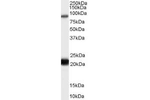 Image no. 1 for anti-RAS Protein Activator Like 1 (GAP1 Like) (RASAL1) (C-Term) antibody (ABIN375234) (RASAL1 Antikörper  (C-Term))