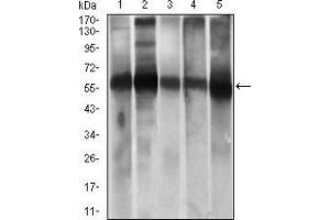 Western blot analysis using ALDH2 mouse mAb against HepG2 (1), A549 (2) cell lysate, and Rat live (3), Mouse liver (4), Mouse brain (5) tissue lysate.