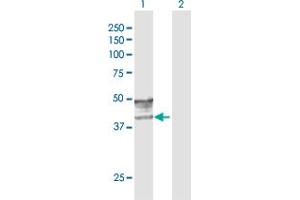 Western Blotting (WB) image for anti-Glucosaminyl (N-Acetyl) Transferase 2, I-Branching Enzyme (I Blood Group) (GCNT2) (AA 1-402) antibody (ABIN947910)