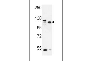 Western blot analysis in MDA-MB435,MCF-7 cell line lysates (35ug/lane). (SEC24C Antikörper  (AA 443-470))