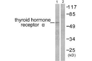 Western Blotting (WB) image for anti-Thyroid Hormone Receptor, alpha (THRA) (N-Term) antibody (ABIN1848804)