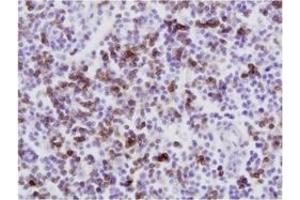 Immunohistochemistry (IHC) image for anti-CD8 (CD8) antibody (ABIN1449140) (CD8 Antikörper)