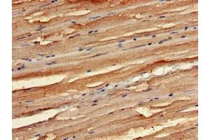 Immunohistochemistry of paraffin-embedded human skeletal muscle tissue using ABIN7168997 at dilution of 1:100 (STK35 Antikörper  (AA 1-200))