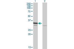 Western Blot analysis of RPA2 expression in transfected 293T cell line by RPA2 MaxPab polyclonal antibody. (RPA2 Antikörper  (AA 1-270))