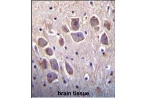 Immunohistochemistry (Paraffin-embedded Sections) (IHC (p)) image for anti-Regulator of Calcineurin 2 (RCAN2) (AA 6-37), (N-Term) antibody (ABIN652191)