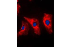 Immunofluorescent analysis of Vimentin staining in MCF7 cells. (Vimentin Antikörper  (C-Term))