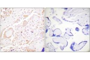 Immunohistochemistry analysis of paraffin-embedded human placenta tissue, using GATA3 (Ab-308) Antibody. (GATA3 Antikörper  (AA 274-323))