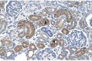Human kidney (DCTPP1 Antikörper  (Middle Region))