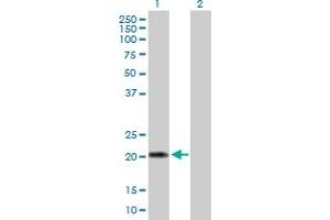 Western Blot analysis of IFNA10 expression in transfected 293T cell line by IFNA10 MaxPab polyclonal antibody. (IFNA10 Antikörper  (AA 1-189))