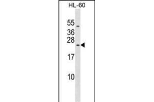 RPL10L Antibody (N-term) (ABIN1539610 and ABIN2849193) western blot analysis in HL-60 cell line lysates (35 μg/lane). (RPL10L Antikörper  (N-Term))