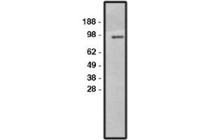 Image no. 1 for anti-Solute Carrier Family 9, Subfamily A (NHE1, Cation Proton Antiporter 1), Member 1 (SLC9A1) antibody (ABIN265248) (SLC9A1 Antikörper)