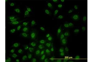 Immunofluorescence of monoclonal antibody to STK17B on HeLa cell. (DRAK2 Antikörper  (AA 272-372))