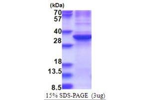 SDS-PAGE (SDS) image for Zinc Finger Protein 32 (ZNF32) (AA 1-273) protein (His tag) (ABIN5853740)