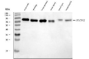 Western blot analysis of CD98/Slc3a2 using anti-CD98/Slc3a2 antibody (ABIN7601428).