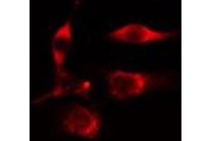 Immunofluorescence (fixed cells) (IF/ICC) image for anti-Aldo-Keto Reductase Family 1, Member C3 (3-alpha Hydroxysteroid Dehydrogenase, Type II) (AKR1C3) antibody (ABIN6259862)