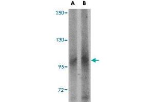 Western blot analysis of LRFN1 in human brain tissue lysate with LRFN1 polyclonal antibody  at (A) 1 and (B) 2 ug/mL . (LRFN1 Antikörper  (C-Term))