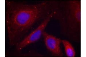 Image no. 3 for anti-P21-Activated Kinase 1 (PAK1) (pThr212) antibody (ABIN196879) (PAK1 Antikörper  (pThr212))