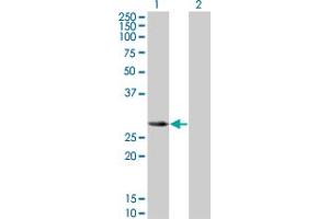Western Blot analysis of SLA2 expression in transfected 293T cell line by SLA2 monoclonal antibody (M01), clone 3G5. (SLAP2 Antikörper  (AA 1-261))