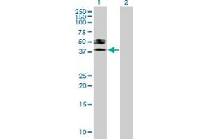 Western Blot analysis of ST6GALNAC6 expression in transfected 293T cell line by ST6GALNAC6 MaxPab polyclonal antibody. (ST6GALNAC6 Antikörper  (AA 1-333))