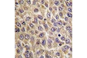 Immunohistochemistry (IHC) image for anti-Integrin-Linked Kinase (ILK) (AA 225-253) antibody (ABIN3031385)