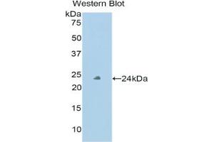 Western blot analysis of the recombinant protein. (Peroxidasin Antikörper  (AA 76-260))